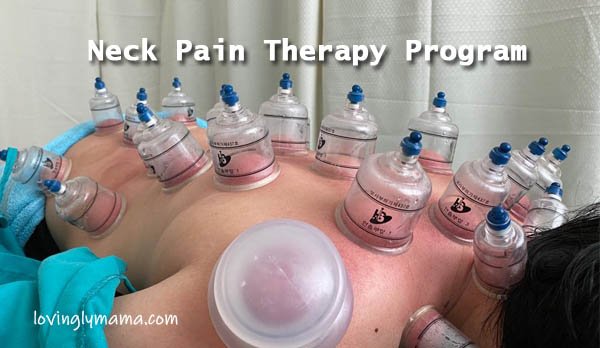 neck pain therapy program in bacolod - upper body therapy - PAPerez Physiotherapy - cupping for stiff neck