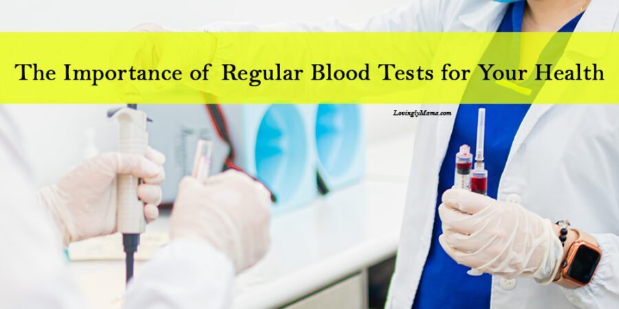 importance of regular blood tests for your health - CBC - blood panel - FBS - cholesterol - heart panel - blood chem - Bacolod laboratory
